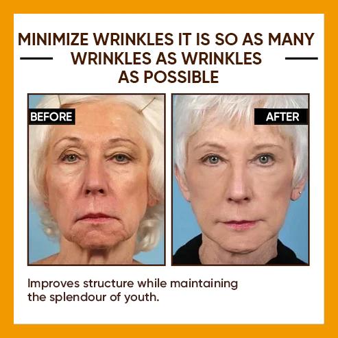 🔥 Full refund for no results after use🔥 2024, Exclusive American premium SEAGRILCOMPLEX technology and well-designed 1-minute wrinkle serum (✅ 1-minute permanent wrinkle reduction ✅ ).