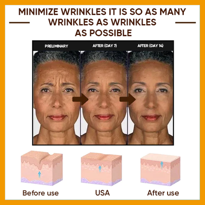 🔥 Full refund for no results after use🔥 2024, Exclusive American premium SEAGRILCOMPLEX technology and well-designed 1-minute wrinkle serum (✅ 1-minute permanent wrinkle reduction ✅ ).