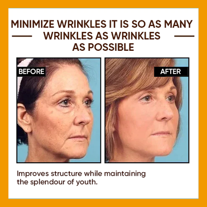 🔥 Full refund for no results after use🔥 2024, Exclusive American premium SEAGRILCOMPLEX technology and well-designed 1-minute wrinkle serum (✅ 1-minute permanent wrinkle reduction ✅ ).